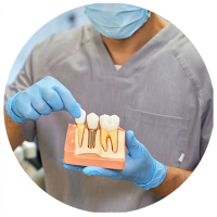 Implantes-dentales