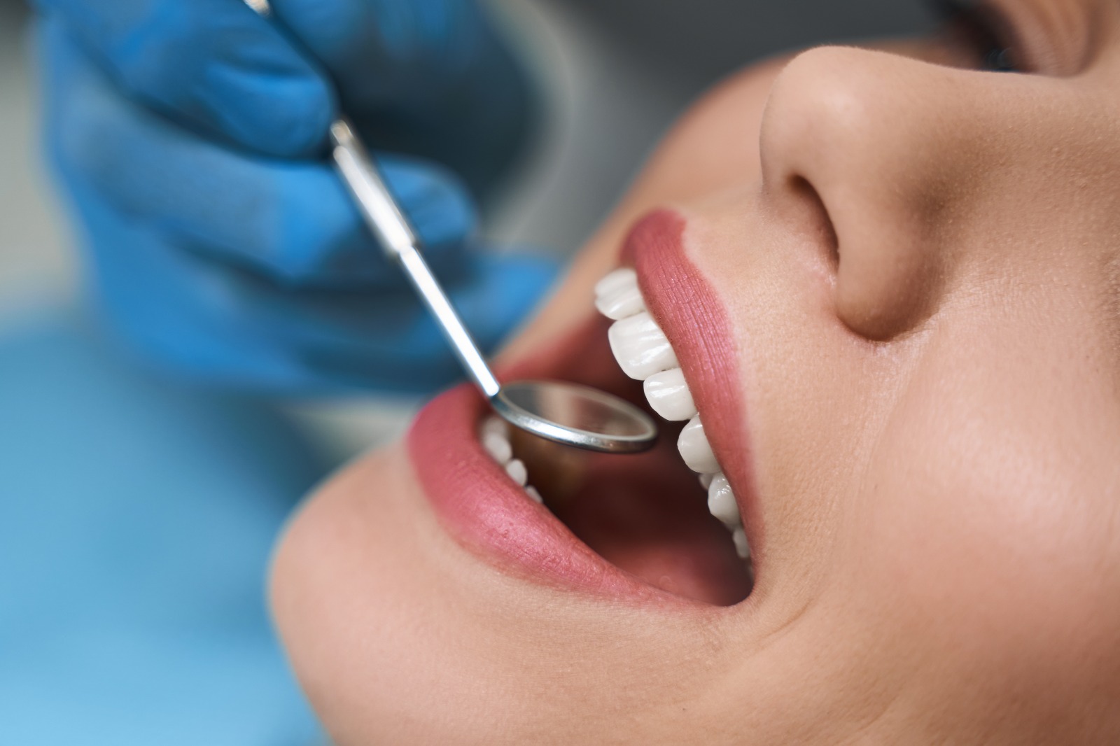 beneficios de la endodoncia