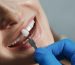 Elegir implantes dentales